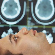 Sclerosi multipla: rabbia e ragione dopo la diagnosi